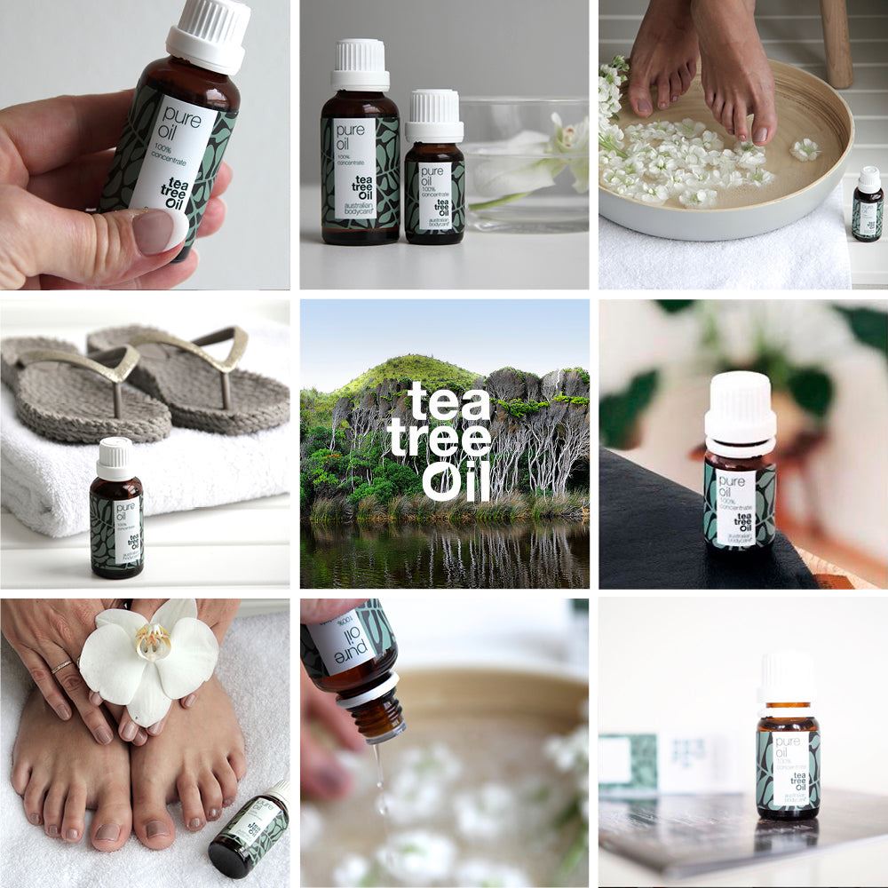 Australian Bodycare Tea Tree Oil 100% Natural for Antibacterial Skin Problems 30ML